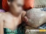 Foto: Addus (26), asal Desa Pajenangger, Kecamatan Arjasa, Kabupaten Sumenep, terbaring lemas karena penyakit yang diderita. Addus (26), asal Desa Pajenangger, Kecamatan Arjasa, Kabupaten Sumenep, terbaring lemas karena penyakit yang diderita.